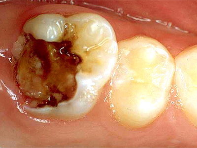 zobozdravnik n-dent